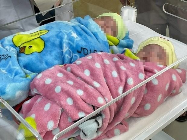 Los gemelos se encuentran en condición estable. (Fotografía: suckhoedoisong.vn)