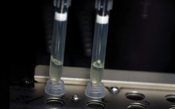 Dos muestras sospechosas de infección por el virus de la viruela del simio están siendo analizadas en el laboratorio de microbiología del Hospital La Paz, Madrid, España, el 1 de junio de 2022. (Fotografía: Reuters)